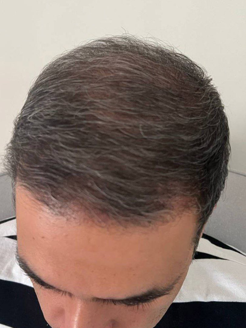 After