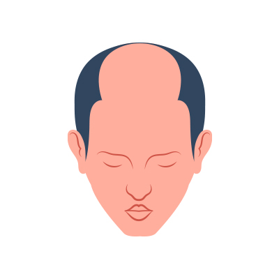 Image for choice number 5