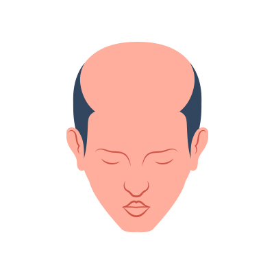 Image for choice number 6